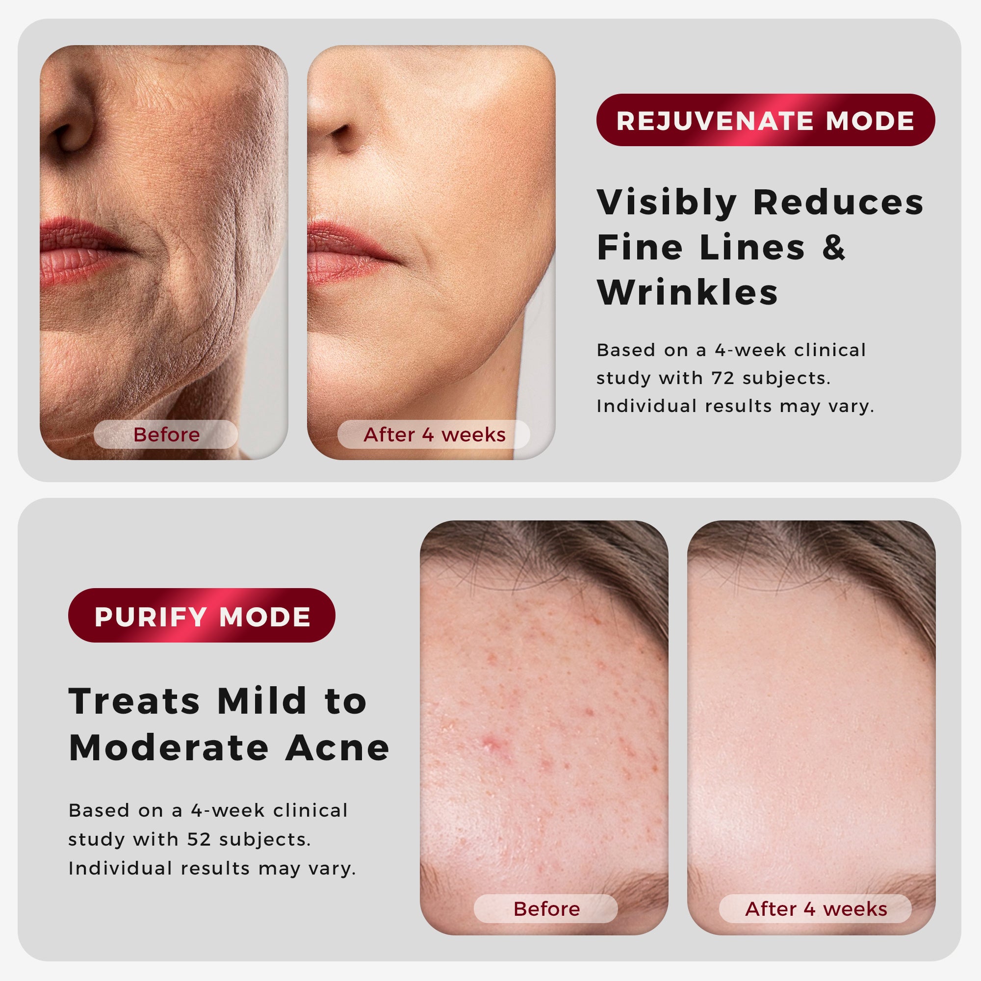 Nephaea LASER&LED Light Therapy Mask