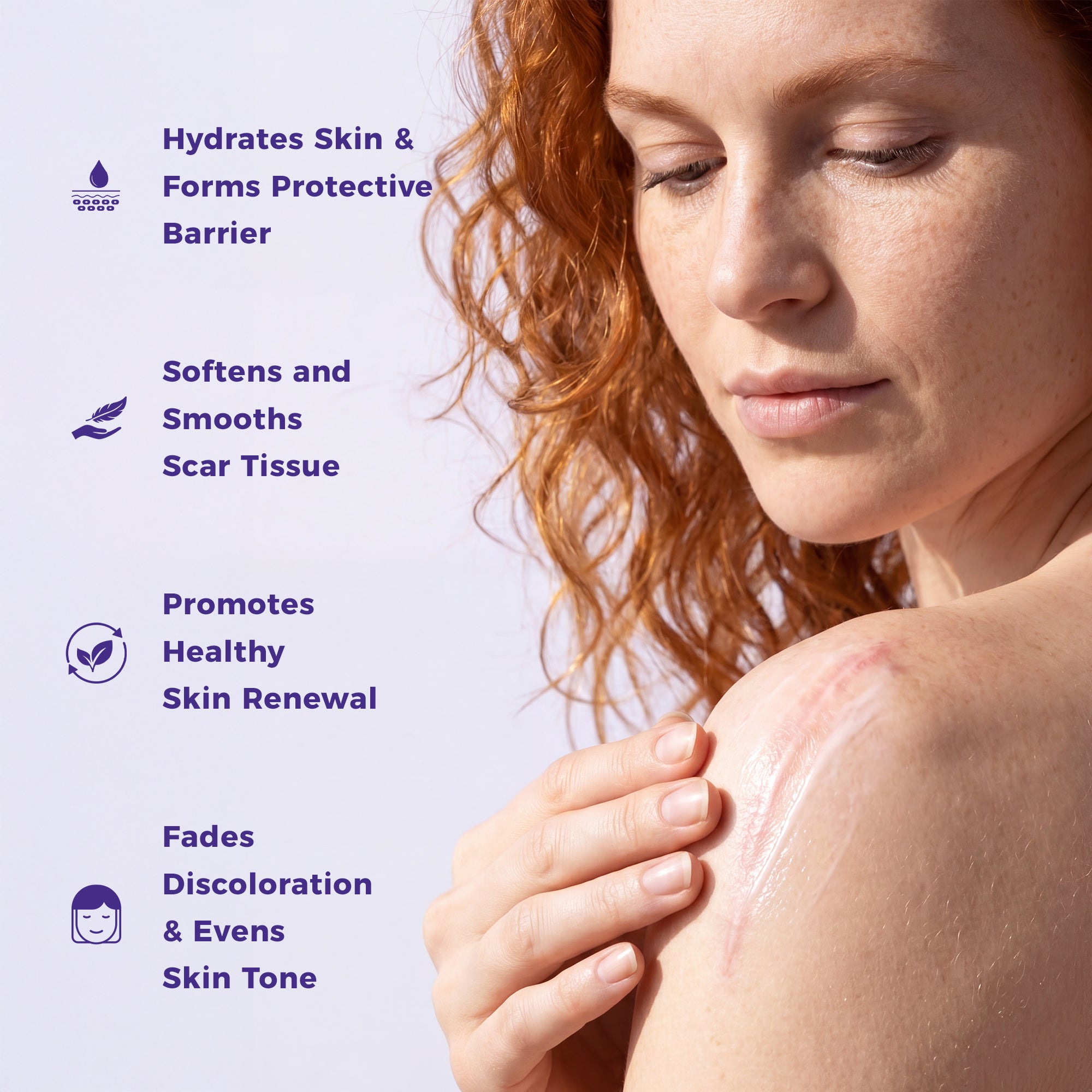 Hydrates skin, softens and smooths the look of scar tissue, promotes healthy-looking skin, fades the look of discoloration